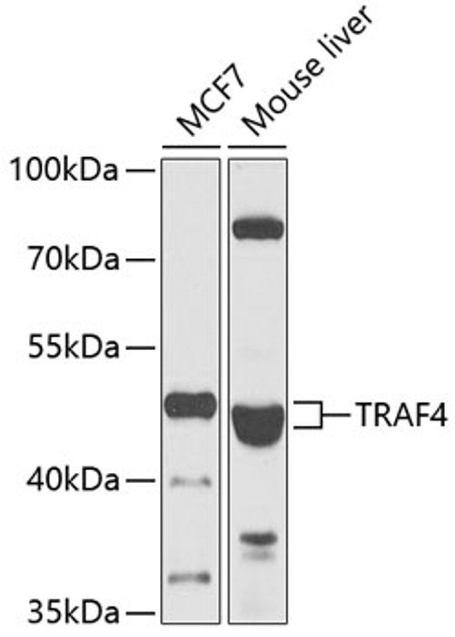 Western blot analysis of extracts of various cell lines, using TRAF4 antibody (22-658) at 1:1000 dilution.<br/>Secondary antibody: HRP Goat Anti-Rabbit IgG (H+L) at 1:10000 dilution.<br/>Lysates/proteins: 25ug per lane.<br/>Blocking buffer: 3% nonfat dry milk in TBST.<br/>Detection: ECL Basic Kit.<br/>Exposure time: 30s.