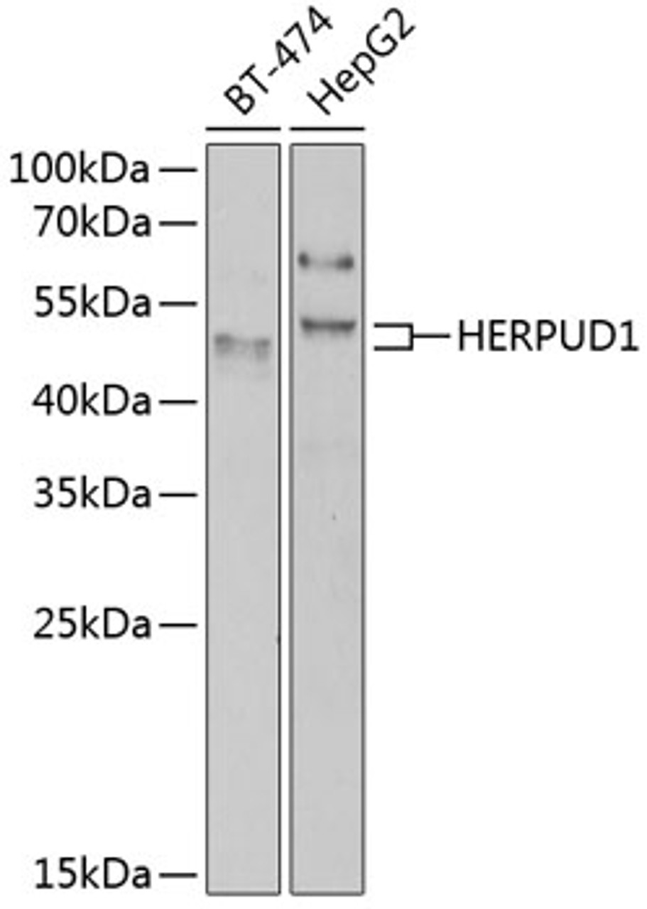 Western blot analysis of extracts of various cell lines, using HERPUD1 antibody (22-659) at 1:1000 dilution.<br/>Secondary antibody: HRP Goat Anti-Rabbit IgG (H+L) at 1:10000 dilution.<br/>Lysates/proteins: 25ug per lane.<br/>Blocking buffer: 3% nonfat dry milk in TBST.<br/>Detection: ECL Basic Kit.<br/>Exposure time: 90s.