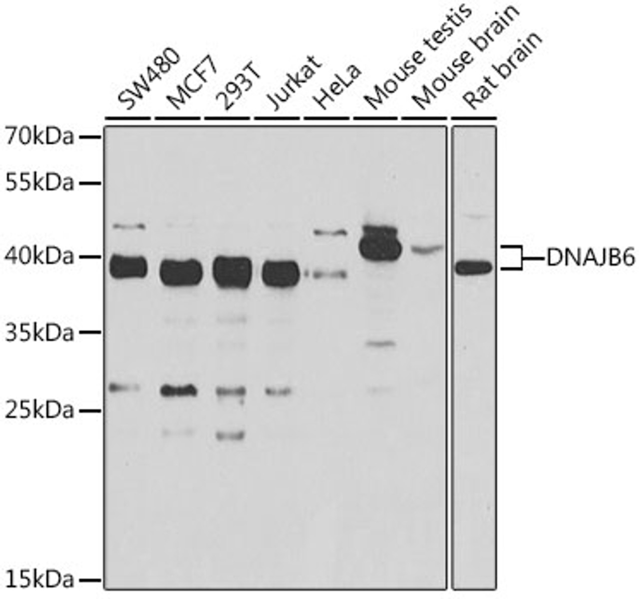 Western blot analysis of extracts of various cell lines, using DNAJB6 antibody (22-660) at 1:1000 dilution.<br/>Secondary antibody: HRP Goat Anti-Rabbit IgG (H+L) at 1:10000 dilution.<br/>Lysates/proteins: 25ug per lane.<br/>Blocking buffer: 3% nonfat dry milk in TBST.<br/>Detection: ECL Basic Kit.<br/>Exposure time: 10s.