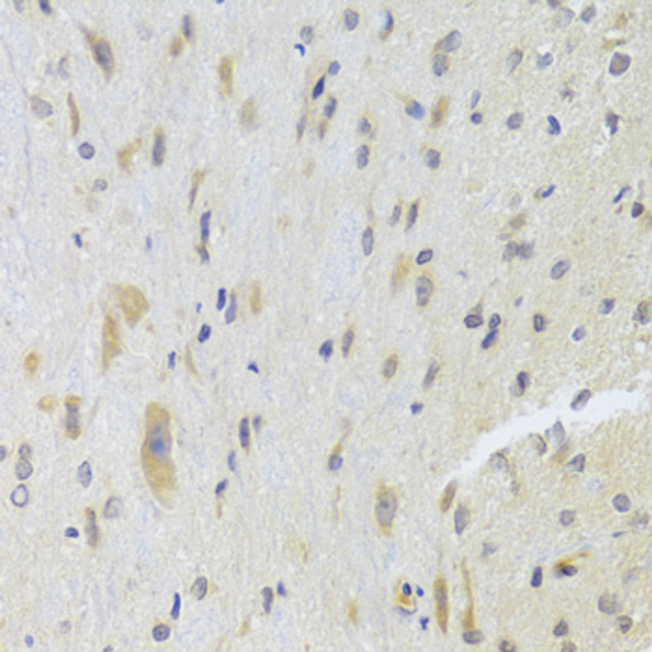 Immunohistochemistry of paraffin-embedded rat spinal cord using DPP3 Antibody (22-662) at dilution of 1:100 (40x lens) .
