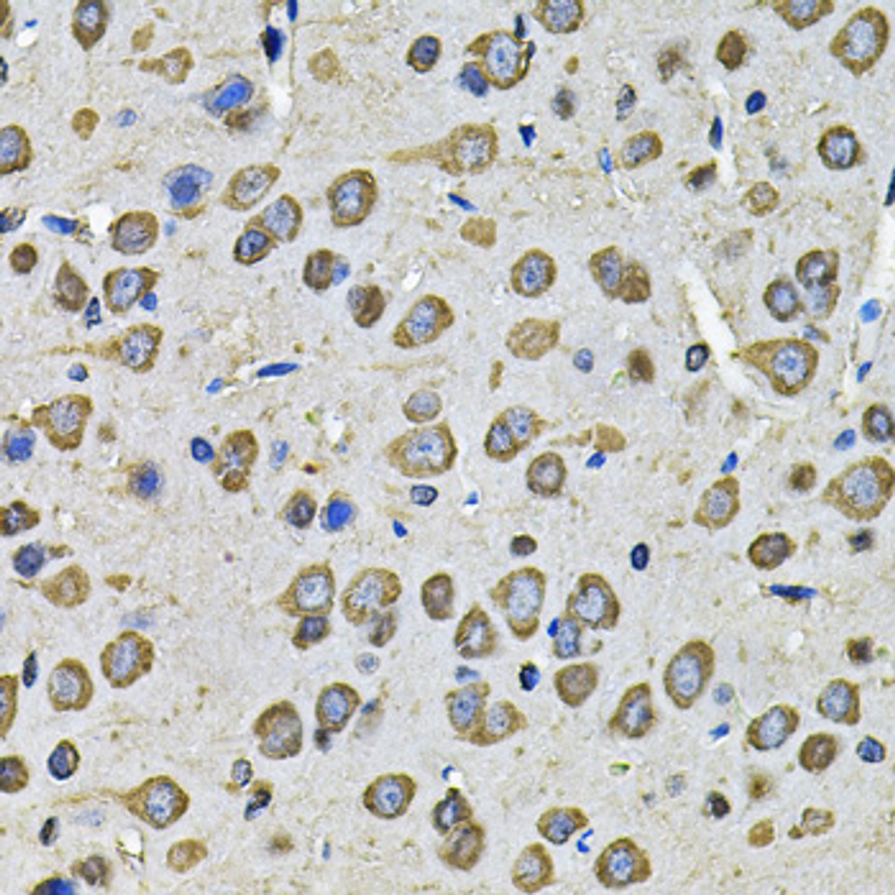 Immunohistochemistry of paraffin-embedded rat brain using PDIA6 Antibody (22-663) at dilution of 1:100 (40x lens) .