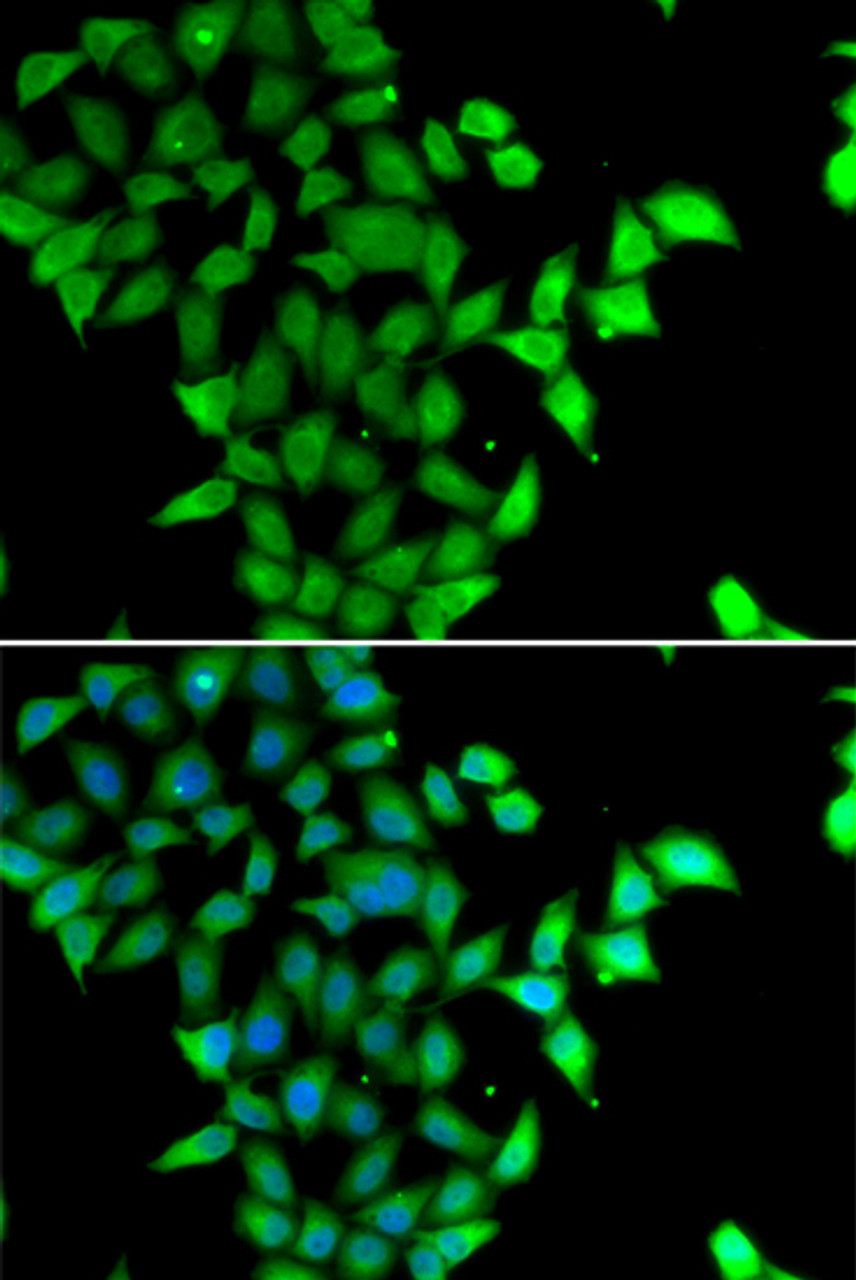 Immunofluorescence analysis of U2OS cells using STAM2 antibody (22-666) . Blue: DAPI for nuclear staining.
