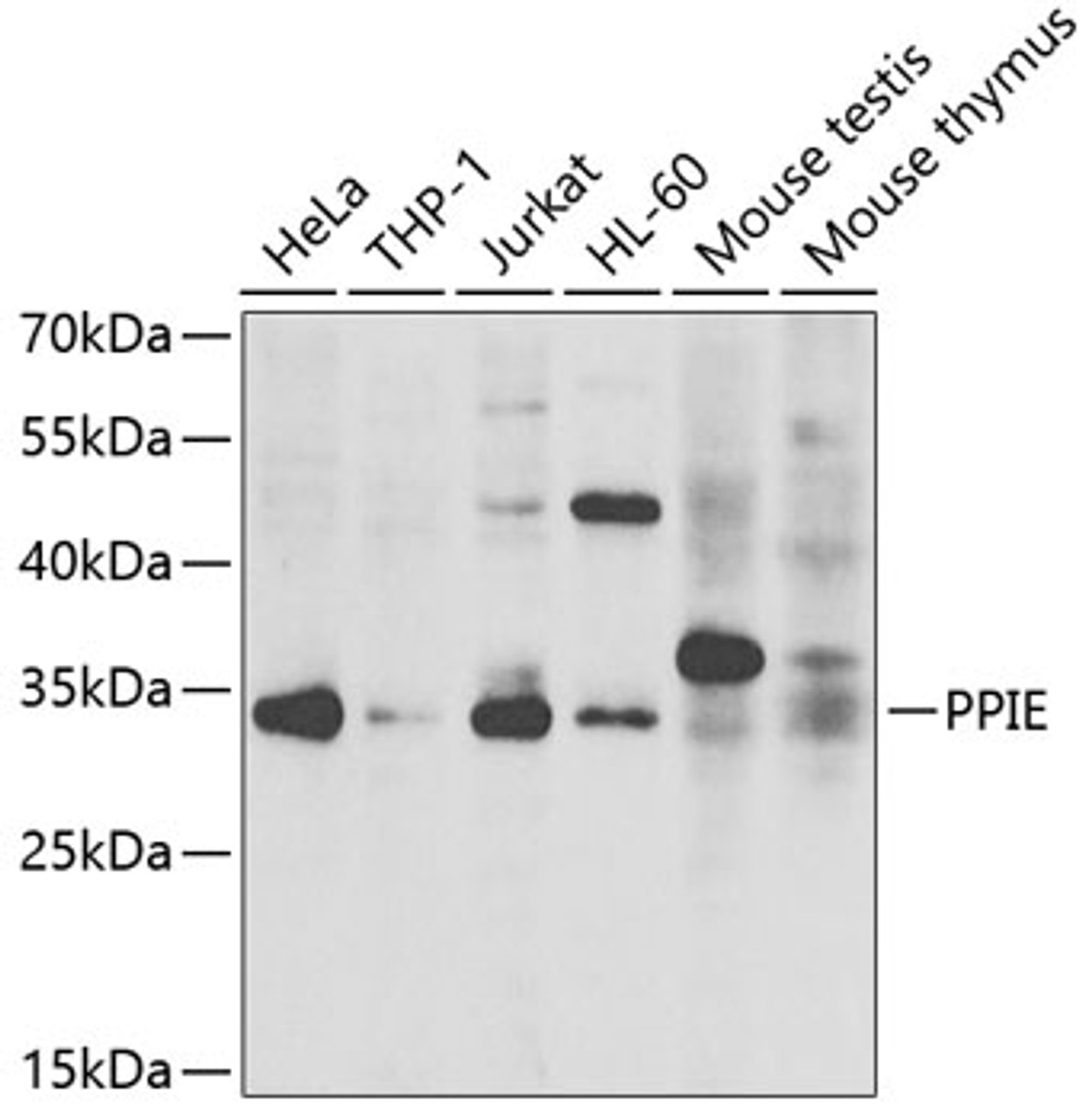 Western blot analysis of extracts of various cell lines, using PPIE antibody (22-668) at 1:1000 dilution.<br/>Secondary antibody: HRP Goat Anti-Rabbit IgG (H+L) at 1:10000 dilution.<br/>Lysates/proteins: 25ug per lane.<br/>Blocking buffer: 3% nonfat dry milk in TBST.<br/>Detection: ECL Basic Kit.<br/>Exposure time: 30s.