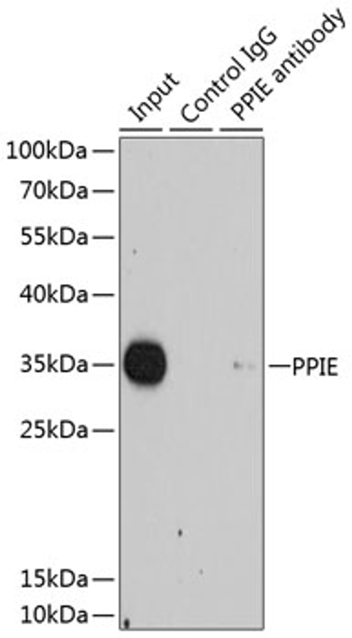 Immunoprecipitation analysis of 200ug extracts of HeLa cells using 1ug PPIE antibody (22-668) . Western blot was performed from the immunoprecipitate using PPIE antibody (22-668) at a dilition of 1:1000.