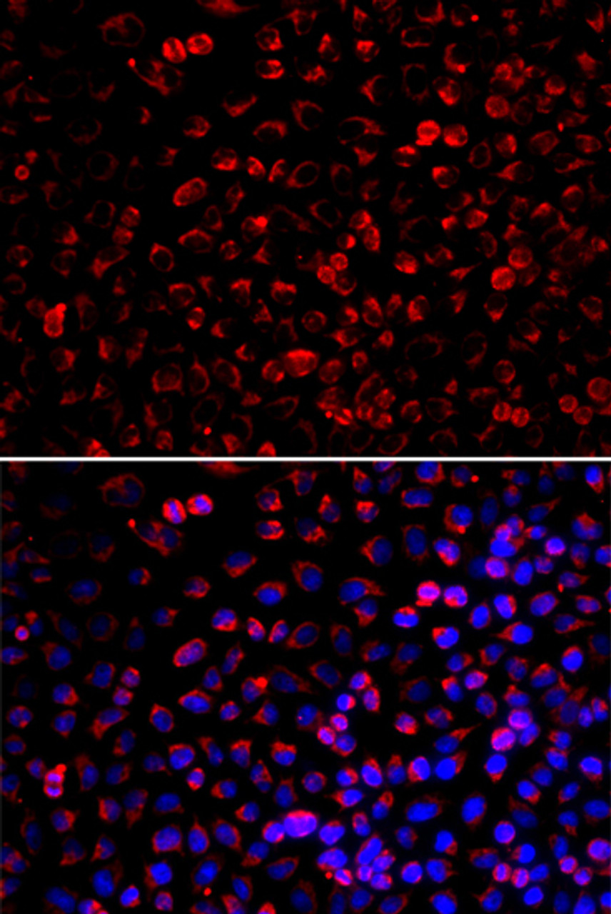 Immunofluorescence analysis of U2OS cells using ENOX2 antibody (22-669) . Blue: DAPI for nuclear staining.