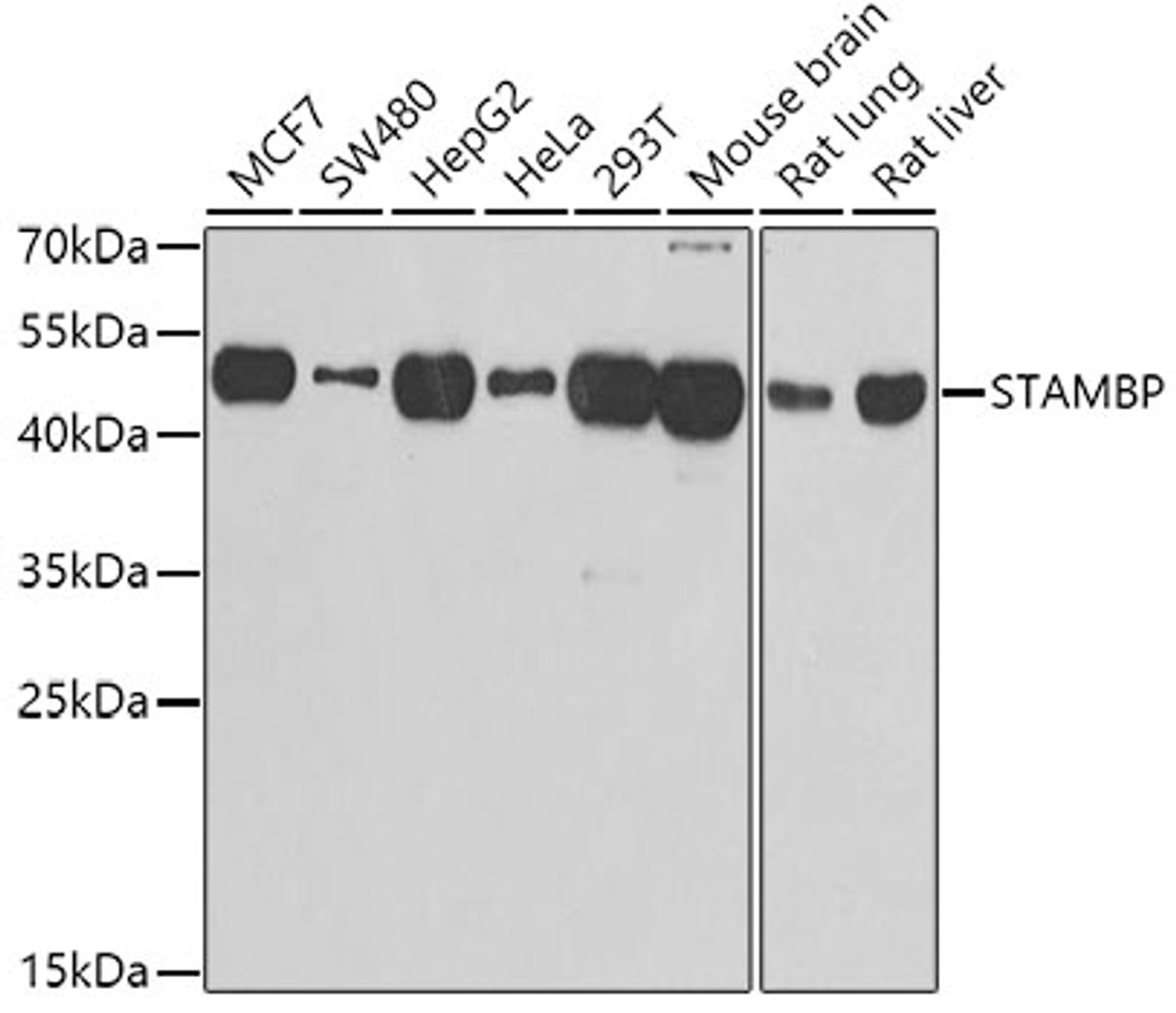 Western blot analysis of extracts of various cell lines, using STAMBP antibody (22-670) at 1:1000 dilution.<br/>Secondary antibody: HRP Goat Anti-Rabbit IgG (H+L) at 1:10000 dilution.<br/>Lysates/proteins: 25ug per lane.<br/>Blocking buffer: 3% nonfat dry milk in TBST.<br/>Detection: ECL Basic Kit.<br/>Exposure time: 30s.