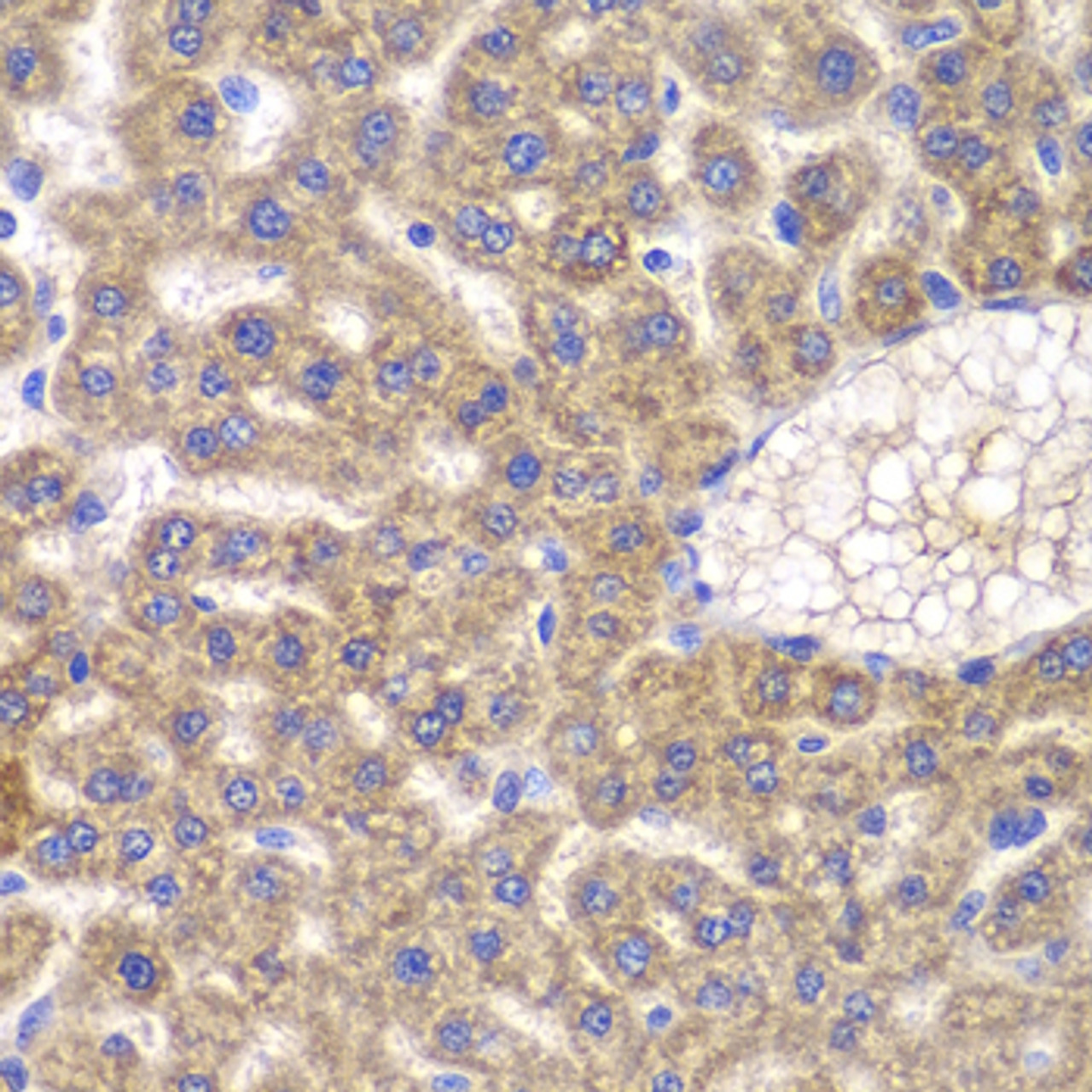 Immunohistochemistry of paraffin-embedded rat liver using FASTK antibody (22-673) at dilution of 1:100 (40x lens) .