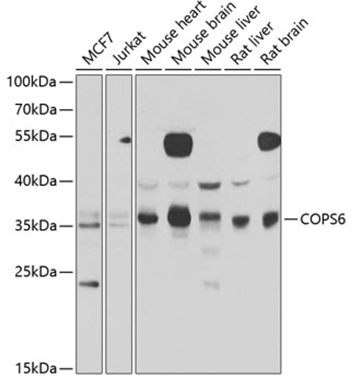 Western blot analysis of extracts of various cell lines, using COPS6 antibody (22-676) at 1:1000 dilution.<br/>Secondary antibody: HRP Goat Anti-Rabbit IgG (H+L) at 1:10000 dilution.<br/>Lysates/proteins: 25ug per lane.<br/>Blocking buffer: 3% nonfat dry milk in TBST.<br/>Detection: ECL Basic Kit.<br/>Exposure time: 10s.