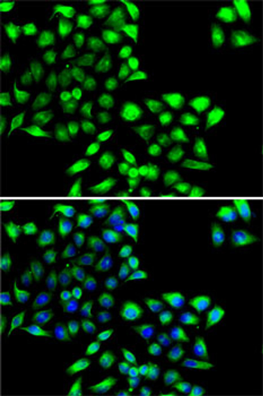 Immunofluorescence analysis of MCF7 cells using COPS6 antibody (22-676) . Blue: DAPI for nuclear staining.