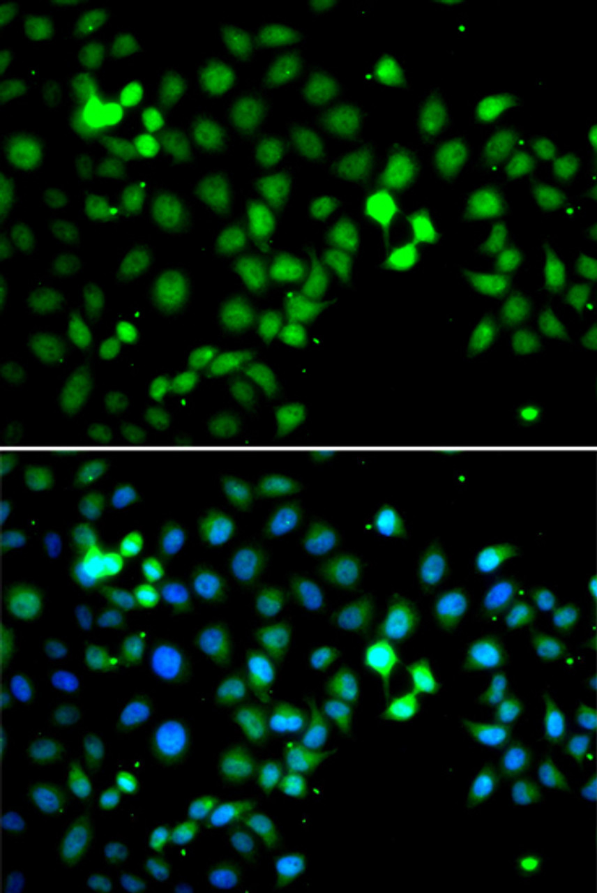 Immunofluorescence analysis of A549 cells using MTF2 antibody (22-680) . Blue: DAPI for nuclear staining.