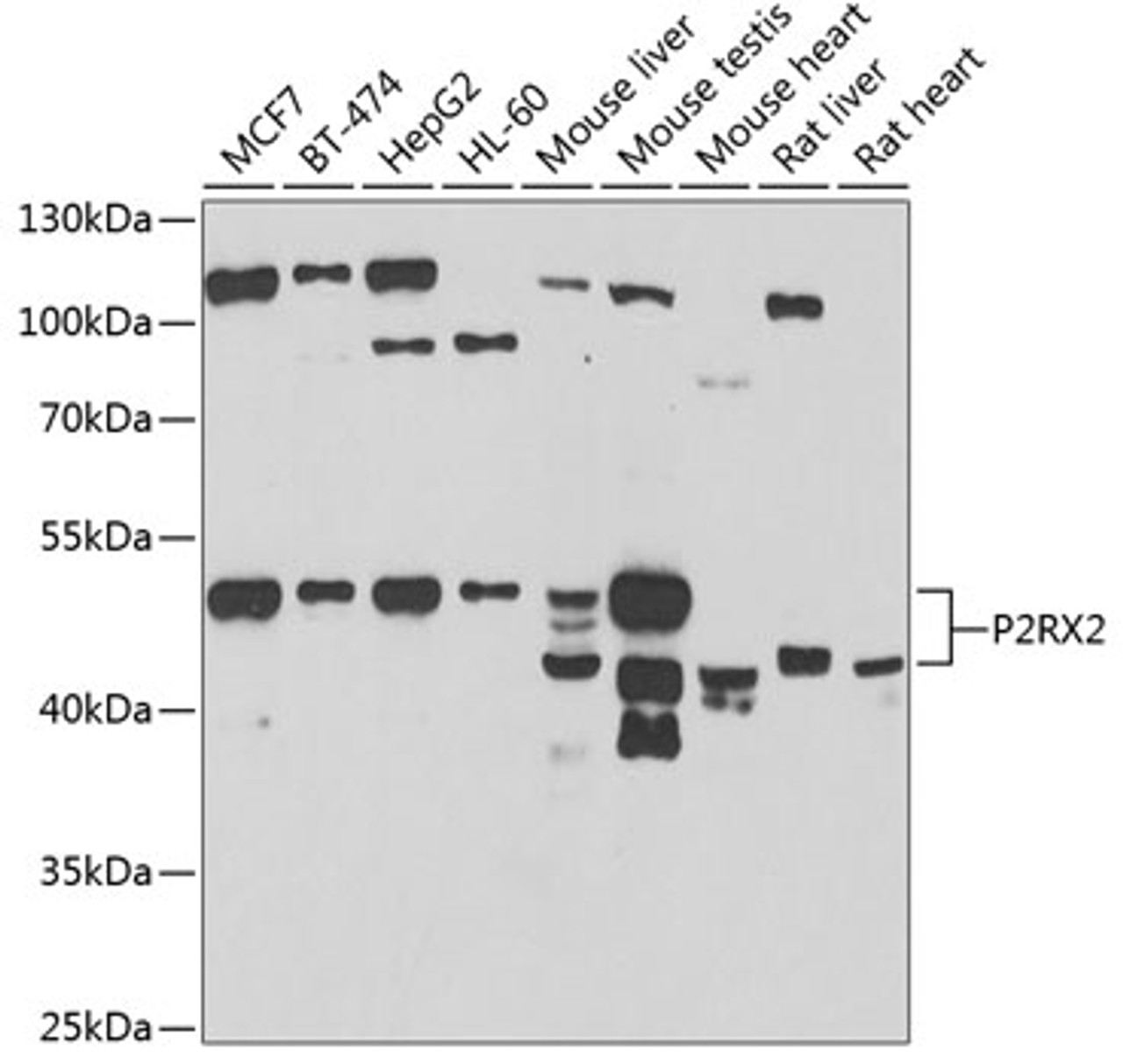 Western blot analysis of extracts of various cell lines, using P2RX2 antibody (22-681) at 1:1000 dilution.<br/>Secondary antibody: HRP Goat Anti-Rabbit IgG (H+L) at 1:10000 dilution.<br/>Lysates/proteins: 25ug per lane.<br/>Blocking buffer: 3% nonfat dry milk in TBST.<br/>Detection: ECL Basic Kit.<br/>Exposure time: 90s.