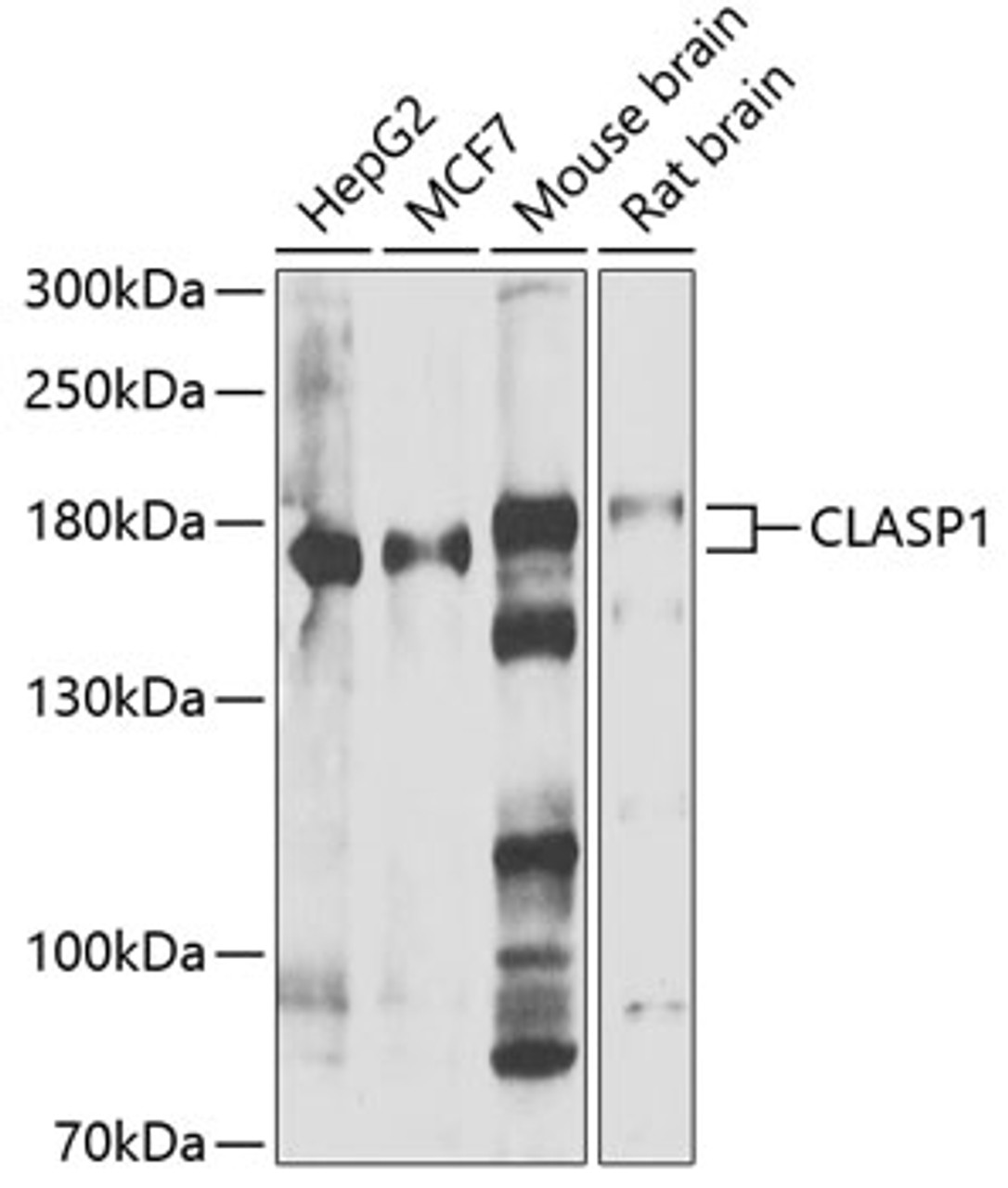 Western blot analysis of extracts of various cell lines, using CLASP1 antibody (22-683) at 1:1000 dilution.<br/>Secondary antibody: HRP Goat Anti-Rabbit IgG (H+L) at 1:10000 dilution.<br/>Lysates/proteins: 25ug per lane.<br/>Blocking buffer: 3% nonfat dry milk in TBST.<br/>Detection: ECL Enhanced Kit.<br/>Exposure time: 10s.
