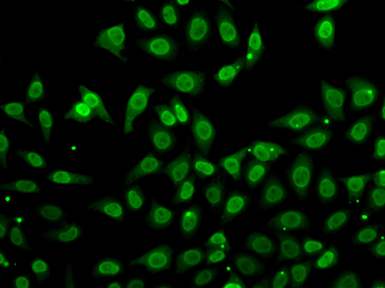 Immunofluorescence analysis of A549 cells using GCA antibody (22-686) .