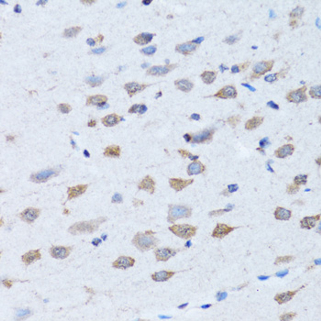 Immunohistochemistry of paraffin-embedded rat brain using LDLRAP1 antibody (22-691) at dilution of 1:100 (40x lens) .