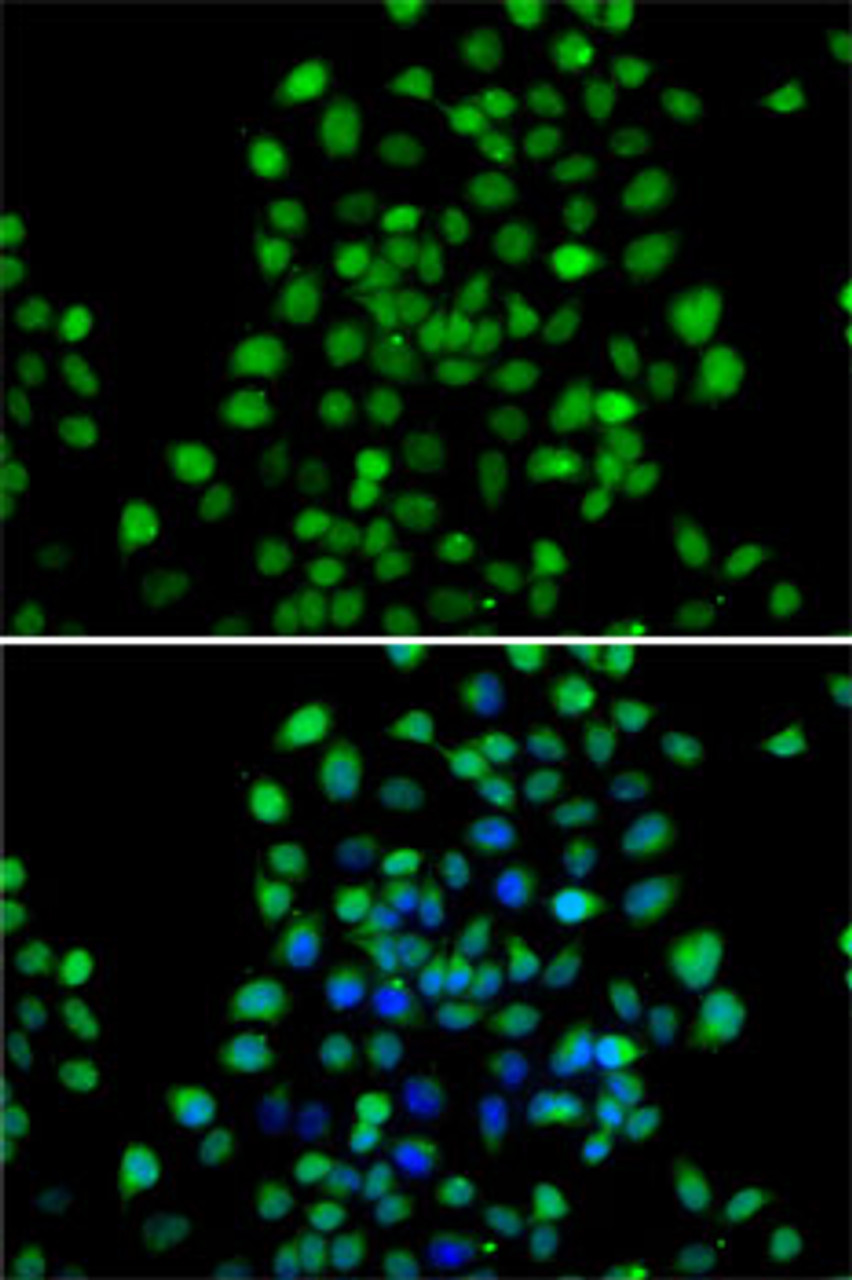 Immunofluorescence analysis of A-549 cells using NTMT1 antibody (22-696) . Blue: DAPI for nuclear staining.