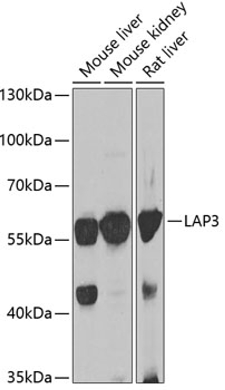Western blot analysis of extracts of various cell lines, using LAP3 antibody (22-699) at 1:1000 dilution.<br/>Secondary antibody: HRP Goat Anti-Rabbit IgG (H+L) at 1:10000 dilution.<br/>Lysates/proteins: 25ug per lane.<br/>Blocking buffer: 3% nonfat dry milk in TBST.<br/>Detection: ECL Basic Kit.<br/>Exposure time: 30s.