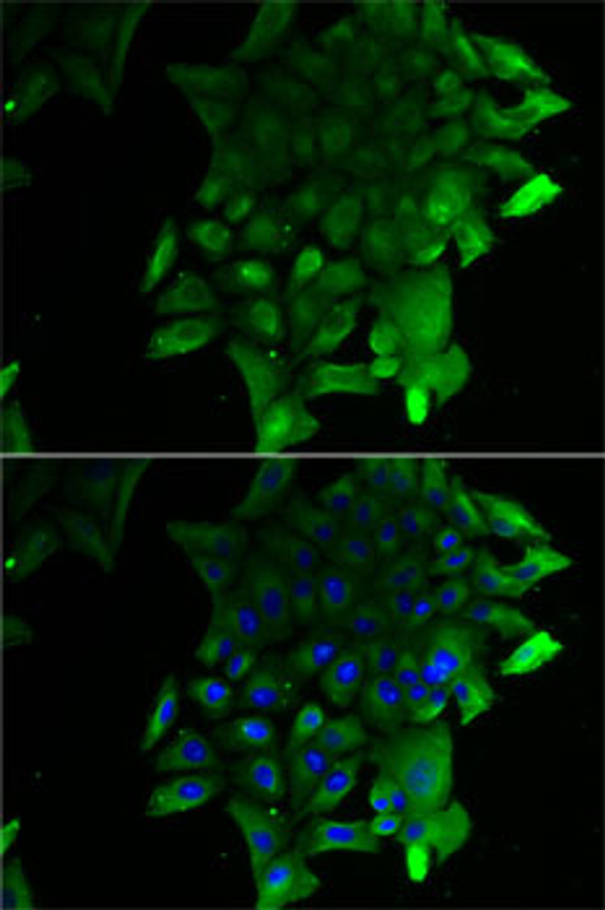 Immunofluorescence analysis of U2OS cells using SEPSECS antibody (22-701) . Blue: DAPI for nuclear staining.