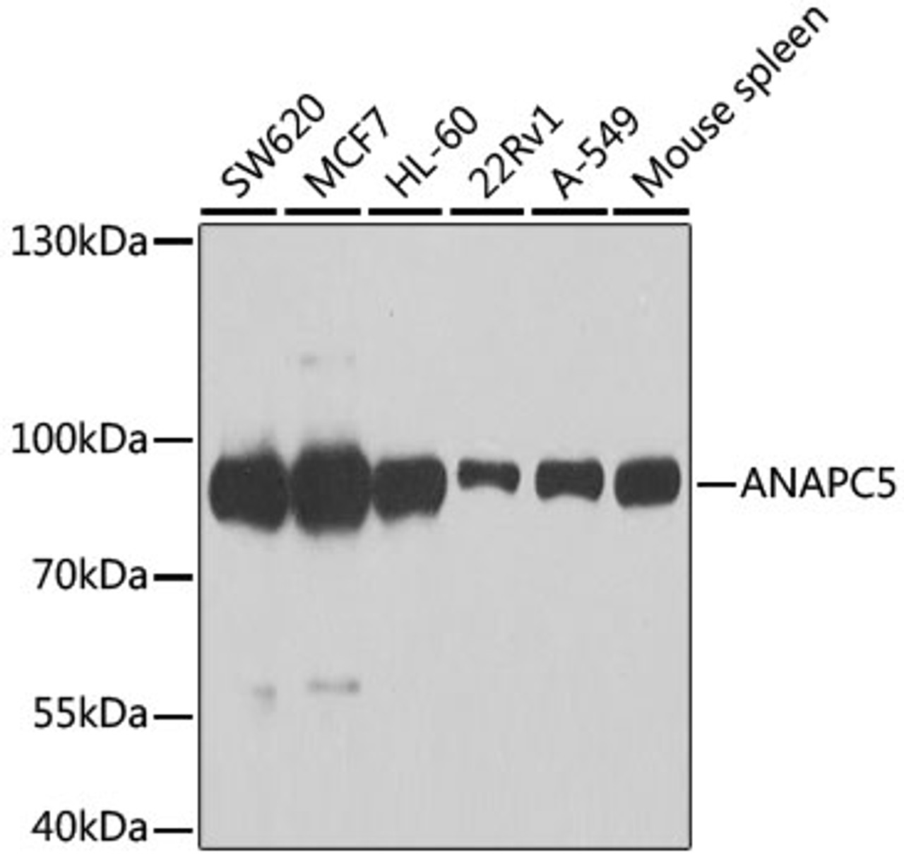 Western blot analysis of extracts of various cell lines, using ANAPC5 antibody (22-706) at 1:1000 dilution.<br/>Secondary antibody: HRP Goat Anti-Rabbit IgG (H+L) at 1:10000 dilution.<br/>Lysates/proteins: 25ug per lane.<br/>Blocking buffer: 3% nonfat dry milk in TBST.<br/>Detection: ECL Basic Kit.<br/>Exposure time: 90s.