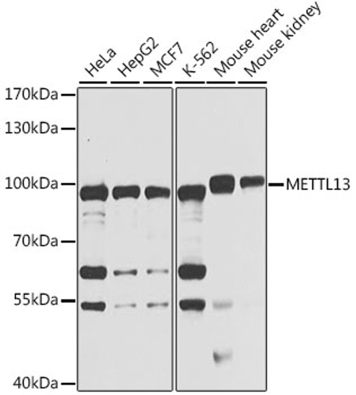 Western blot analysis of extracts of various cell lines, using METTL13 antibody (22-708) at 1:1000 dilution.<br/>Secondary antibody: HRP Goat Anti-Rabbit IgG (H+L) at 1:10000 dilution.<br/>Lysates/proteins: 25ug per lane.<br/>Blocking buffer: 3% nonfat dry milk in TBST.<br/>Detection: ECL Basic Kit.<br/>Exposure time: 10s.