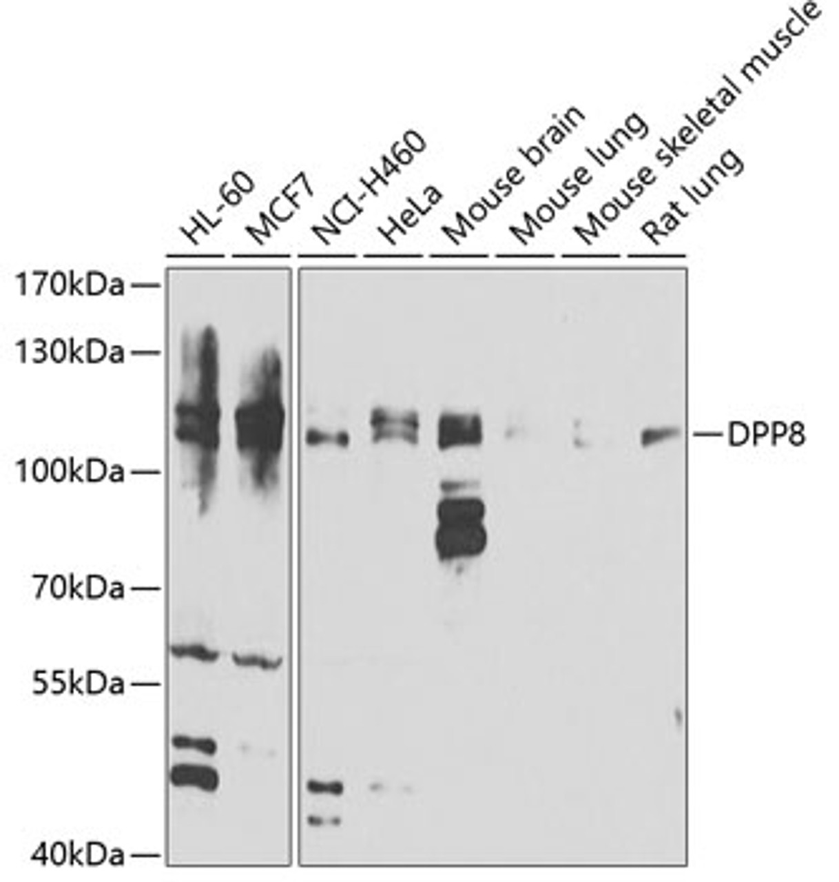 Western blot analysis of extracts of various cell lines, using DPP8 antibody (22-710) at 1:1000 dilution.<br/>Secondary antibody: HRP Goat Anti-Rabbit IgG (H+L) at 1:10000 dilution.<br/>Lysates/proteins: 25ug per lane.<br/>Blocking buffer: 3% nonfat dry milk in TBST.<br/>Detection: ECL Basic Kit.<br/>Exposure time: 30s.