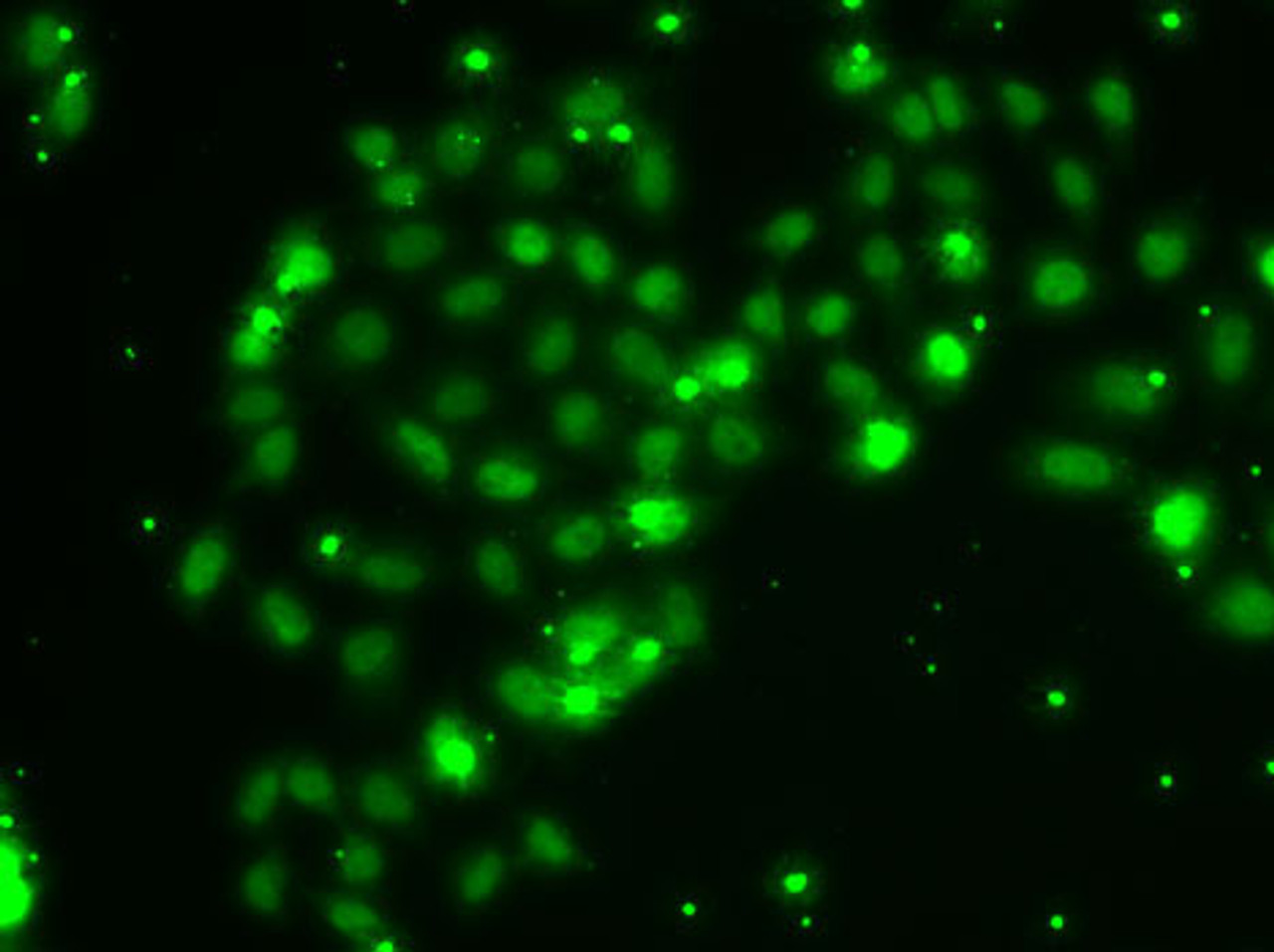 Immunofluorescence analysis of A-549 cells using TXNL4B antibody (22-711) .