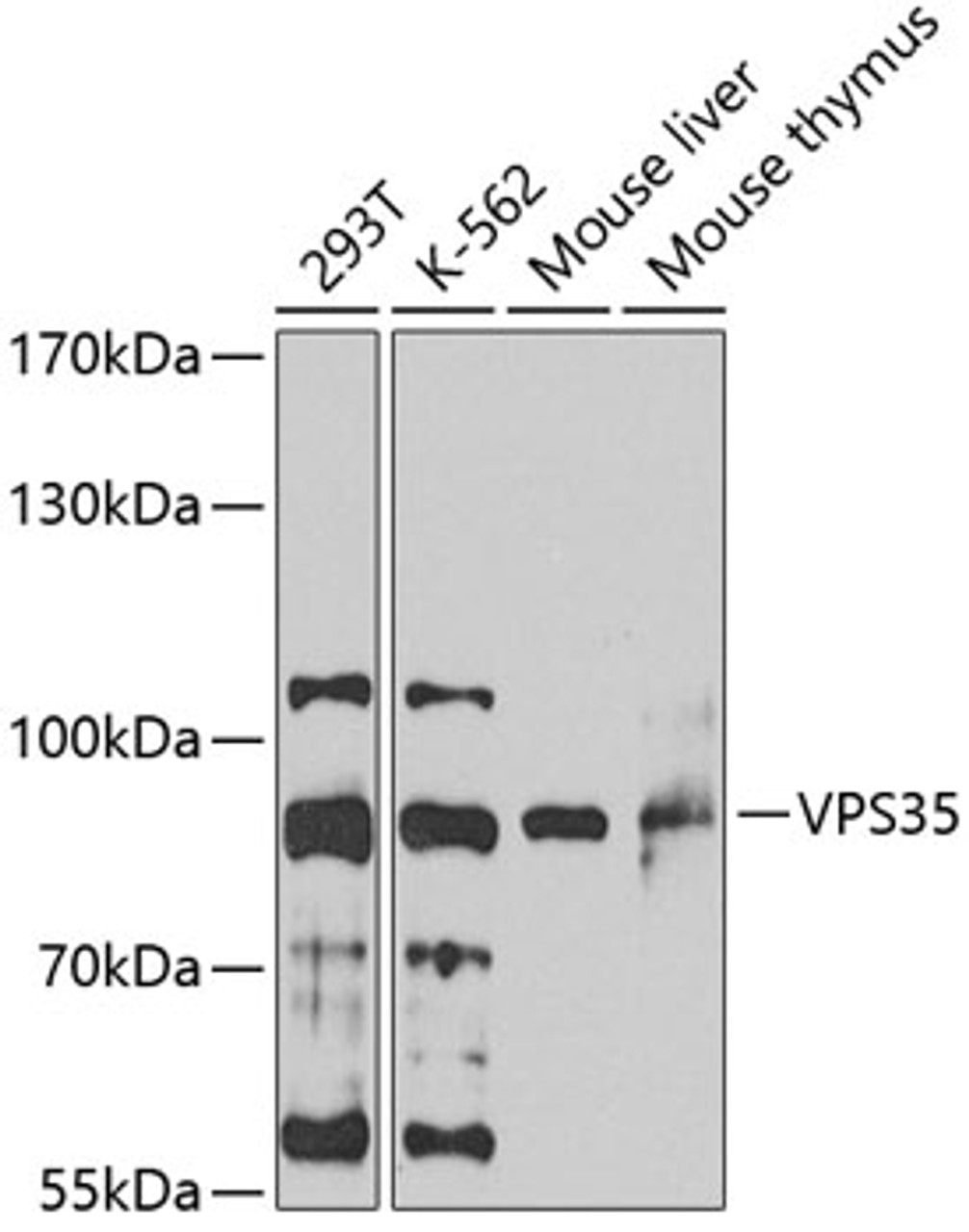 Western blot analysis of extracts of various cell lines, using VPS35 antibody (22-714) at 1:1000 dilution._Secondary antibody: HRP Goat Anti-Rabbit IgG (H+L) at 1:10000 dilution._Lysates/proteins: 25ug per lane._Blocking buffer: 3% nonfat dry milk in TBST._Detection: ECL Enhanced Kit._Exposure time: 60s.