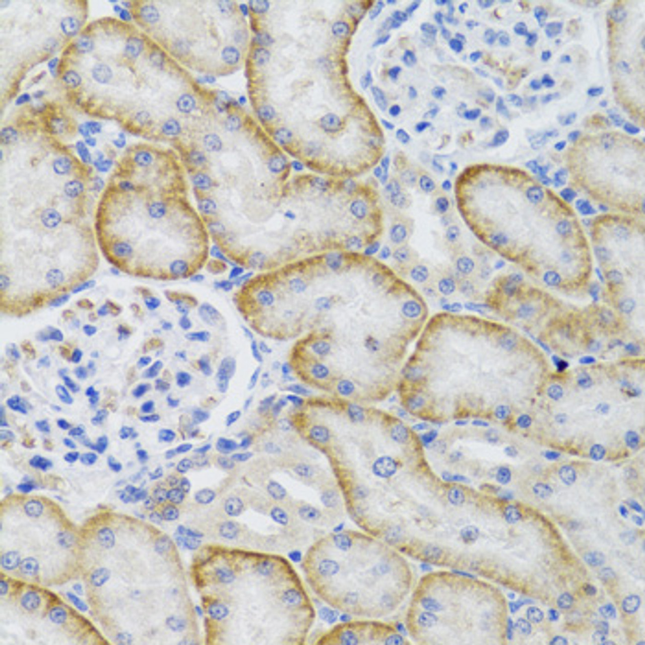 Immunohistochemistry of paraffin-embedded rat kidney using ARFGAP1 antibody (22-715) at dilution of 1:100 (40x lens) .