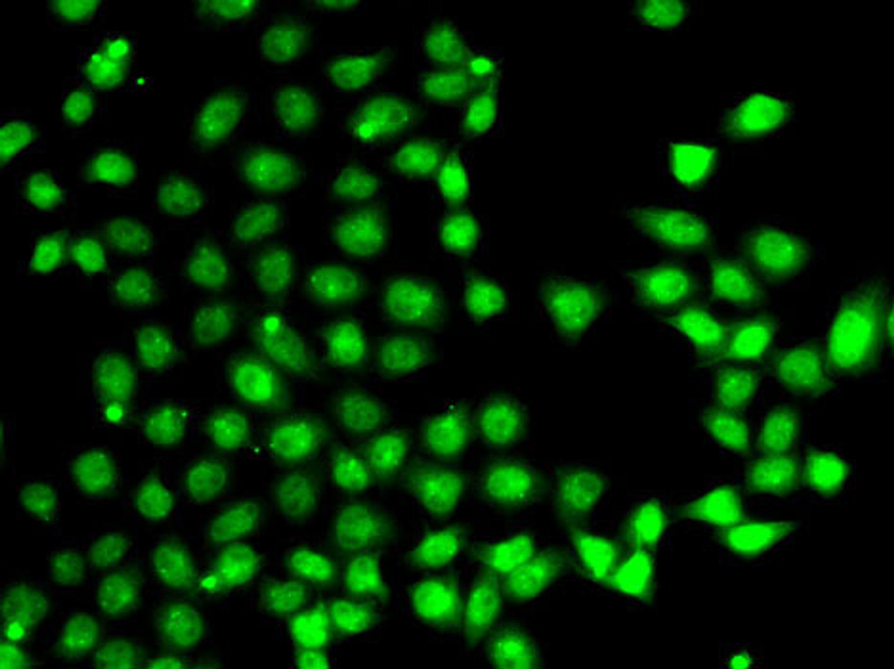 Immunofluorescence analysis of A-549 cells using EAF2 antibody (22-716) .