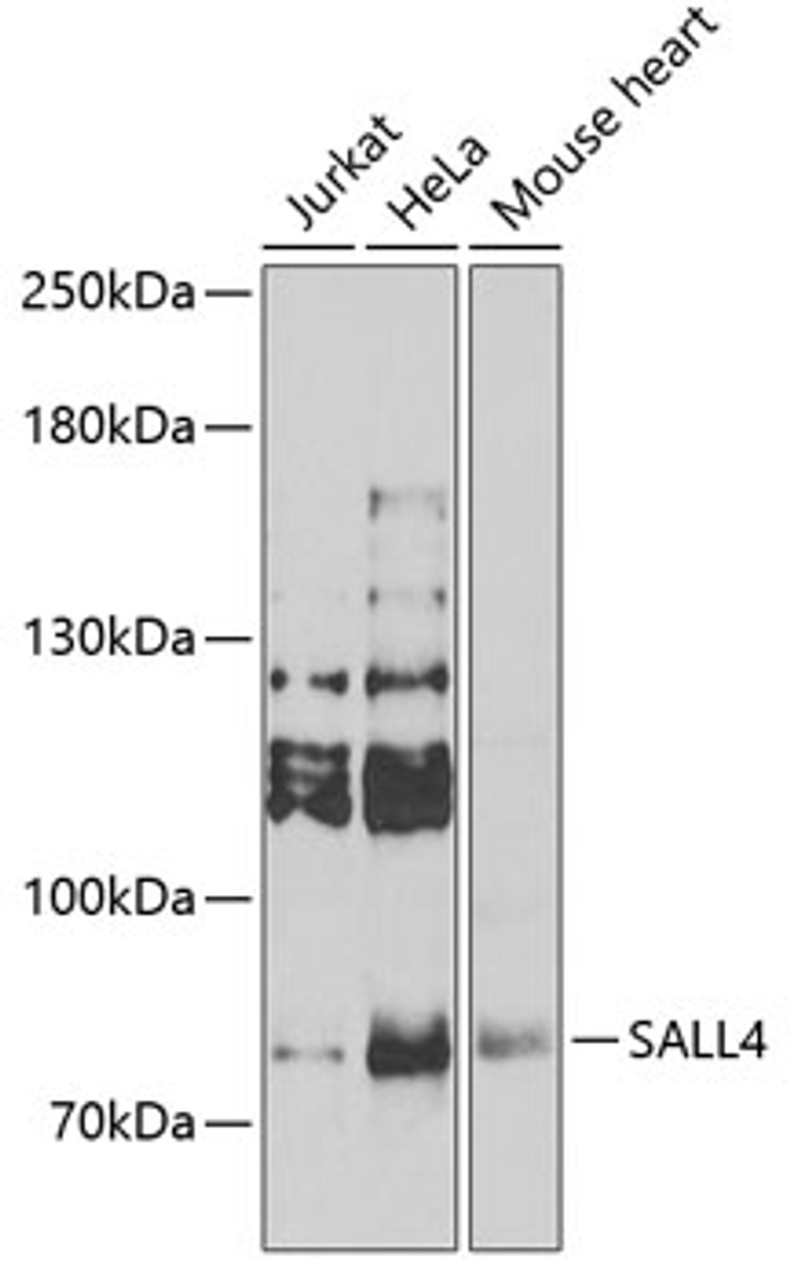Western blot analysis of extracts of various cell lines, using SALL4 Antibody (22-720) at 1:1000 dilution._Secondary antibody: HRP Goat Anti-Rabbit IgG (H+L) at 1:10000 dilution._Lysates/proteins: 25ug per lane._Blocking buffer: 3% nonfat dry milk in TBST._Detection: ECL Enhanced Kit._Exposure time: 90s.