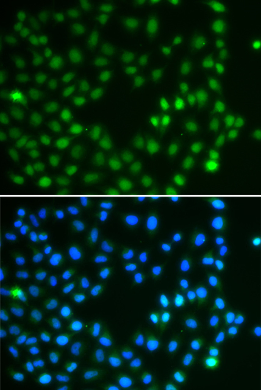 Immunofluorescence analysis of A549 cells using SALL4 antibody (22-720) . Blue: DAPI for nuclear staining.