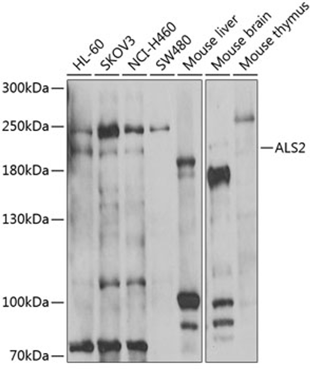 Western blot analysis of extracts of various cell lines, using ALS2 antibody (22-721) at 1:1000 dilution.<br/>Secondary antibody: HRP Goat Anti-Rabbit IgG (H+L) at 1:10000 dilution.<br/>Lysates/proteins: 25ug per lane.<br/>Blocking buffer: 3% nonfat dry milk in TBST.<br/>Detection: ECL Basic Kit.<br/>Exposure time: 90s.