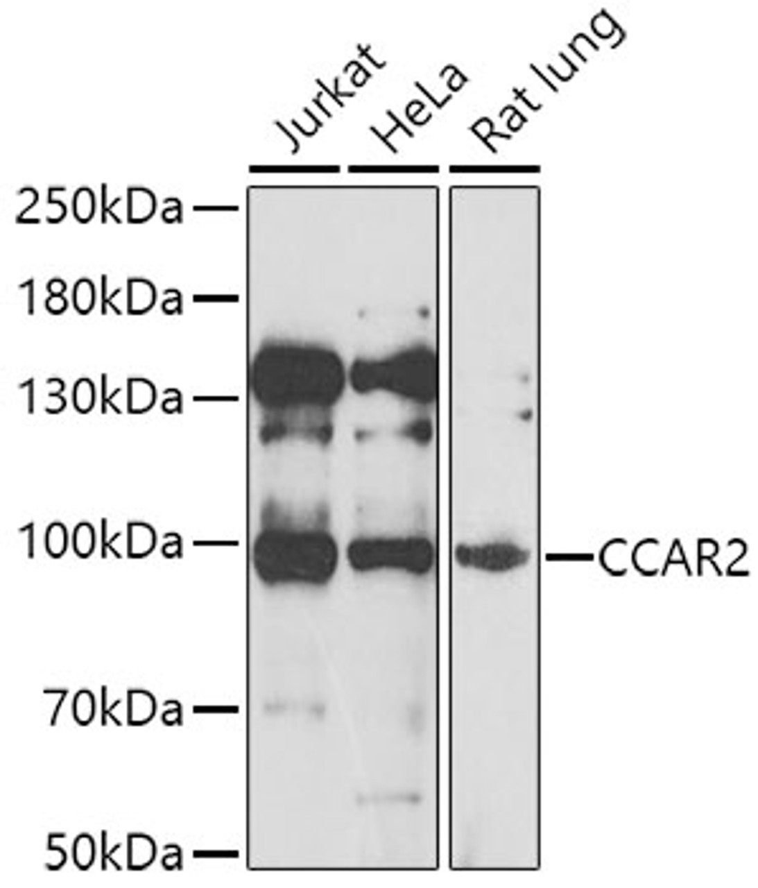 Western blot analysis of extracts of various cell lines, using CCAR2 antibody (22-722) at 1:1000 dilution.<br/>Secondary antibody: HRP Goat Anti-Rabbit IgG (H+L) at 1:10000 dilution.<br/>Lysates/proteins: 25ug per lane.<br/>Blocking buffer: 3% nonfat dry milk in TBST.<br/>Detection: ECL Basic Kit.<br/>Exposure time: 30s.