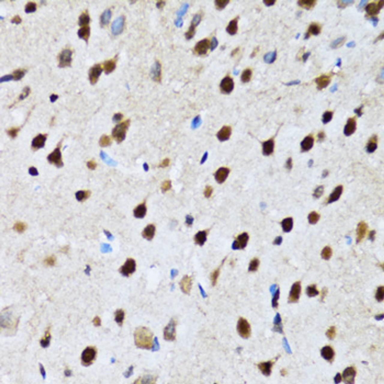 Immunohistochemistry of paraffin-embedded rat brain using CCAR2 antibody (22-722) at dilution of 1:100 (40x lens) .