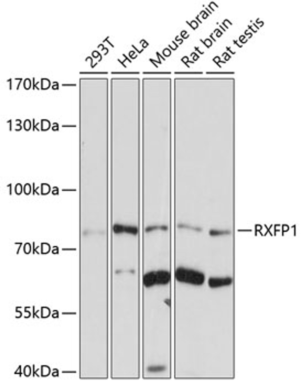 Western blot analysis of extracts of various cell lines, using RXFP1 antibody (22-723) at 1:1000 dilution.<br/>Secondary antibody: HRP Goat Anti-Rabbit IgG (H+L) at 1:10000 dilution.<br/>Lysates/proteins: 25ug per lane.<br/>Blocking buffer: 3% nonfat dry milk in TBST.<br/>Detection: ECL Basic Kit.<br/>Exposure time: 30s.