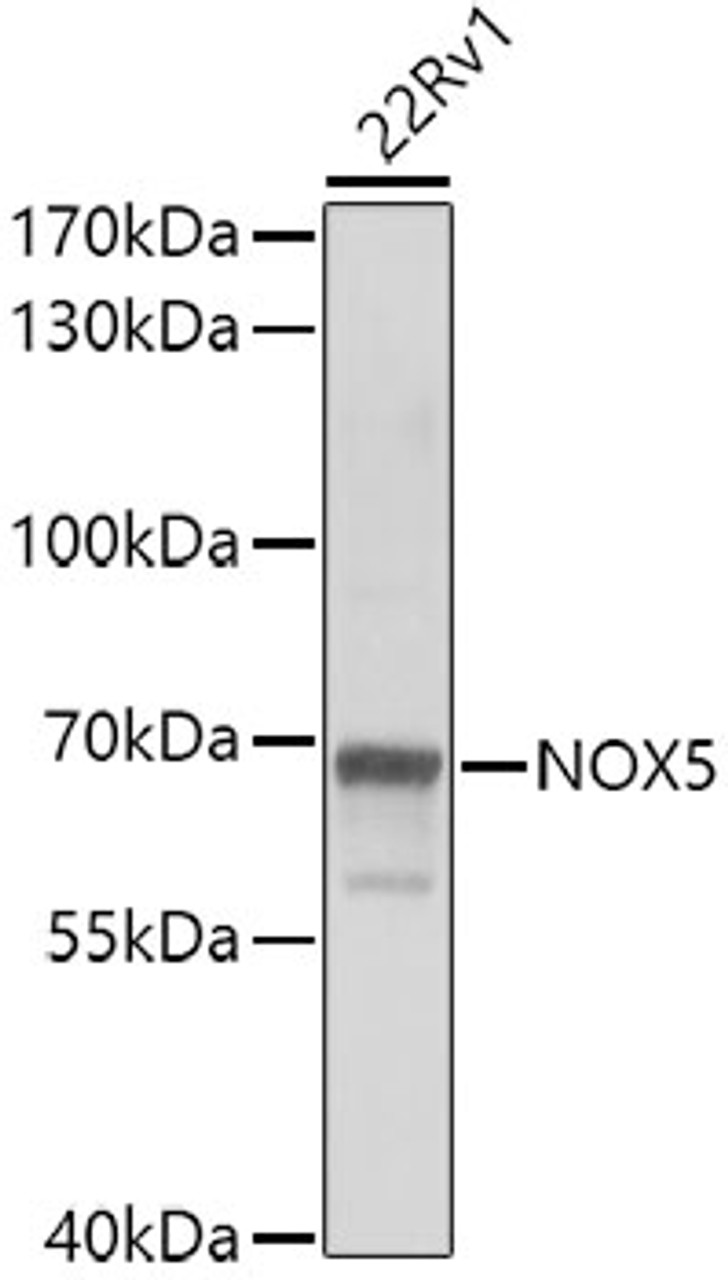 Western blot analysis of extracts of 22Rv1 cells, using NOX5 antibody (22-731) at 1:1000 dilution.<br/>Secondary antibody: HRP Goat Anti-Rabbit IgG (H+L) at 1:10000 dilution.<br/>Lysates/proteins: 25ug per lane.<br/>Blocking buffer: 3% nonfat dry milk in TBST.<br/>Detection: ECL Basic Kit.<br/>Exposure time: 30s.