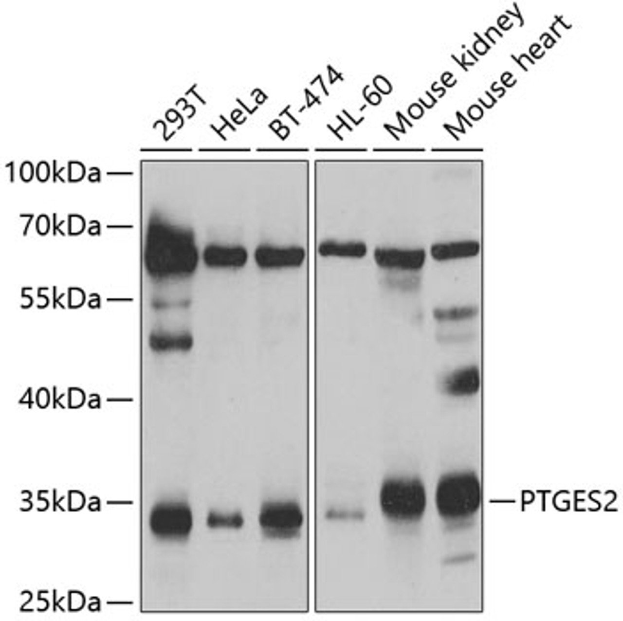 Western blot analysis of extracts of various cell lines, using PTGES2 antibody (22-732) at 1:1000 dilution.<br/>Secondary antibody: HRP Goat Anti-Rabbit IgG (H+L) at 1:10000 dilution.<br/>Lysates/proteins: 25ug per lane.<br/>Blocking buffer: 3% nonfat dry milk in TBST.<br/>Detection: ECL Basic Kit.<br/>Exposure time: 5s.