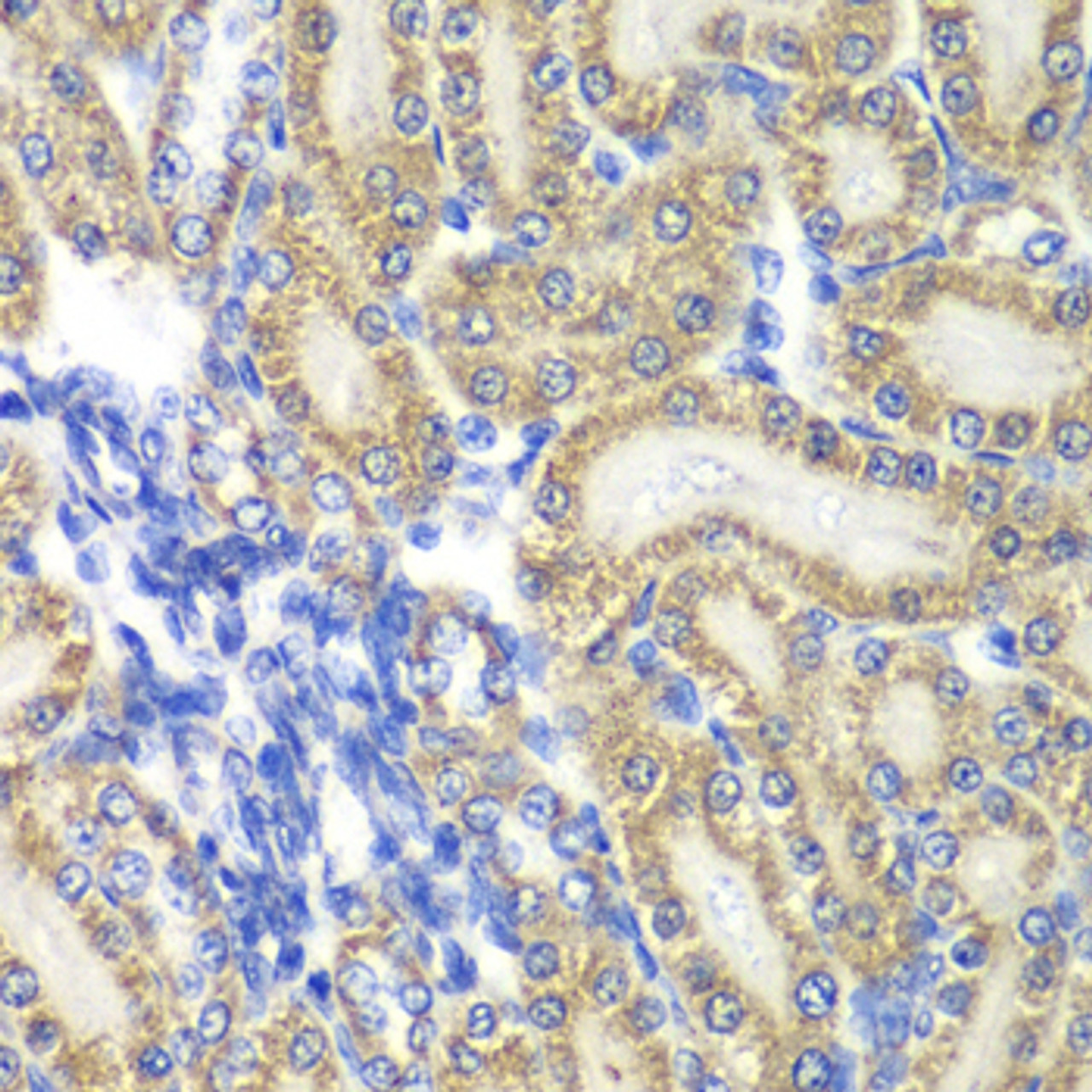 Immunohistochemistry of paraffin-embedded rat kidney using PTGES2 antibody (22-732) at dilution of 1:100 (40x lens) .