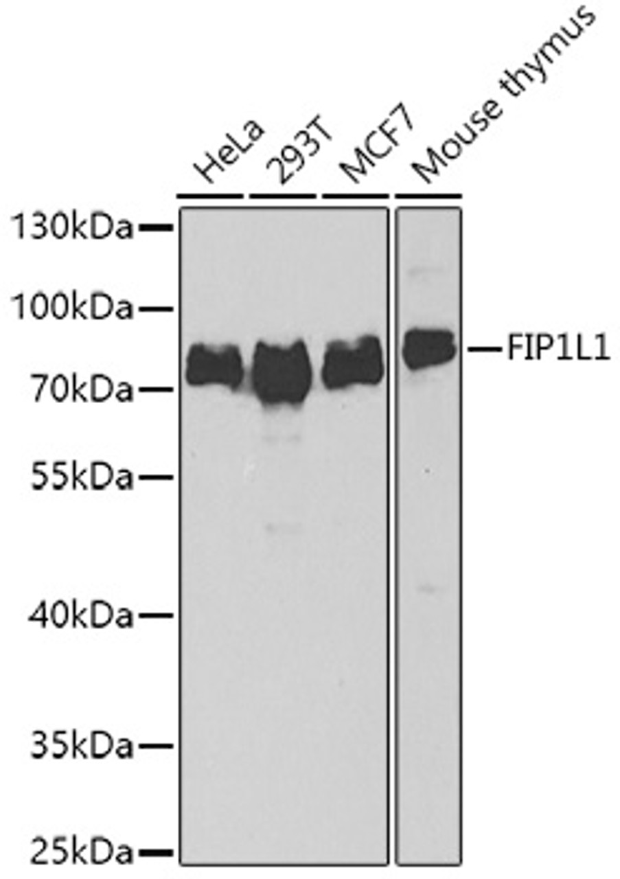 Western blot analysis of extracts of various cell lines, using FIP1L1 antibody (22-733) at 1:1000 dilution.<br/>Secondary antibody: HRP Goat Anti-Rabbit IgG (H+L) at 1:10000 dilution.<br/>Lysates/proteins: 25ug per lane.<br/>Blocking buffer: 3% nonfat dry milk in TBST.<br/>Detection: ECL Basic Kit.<br/>Exposure time: 90s.