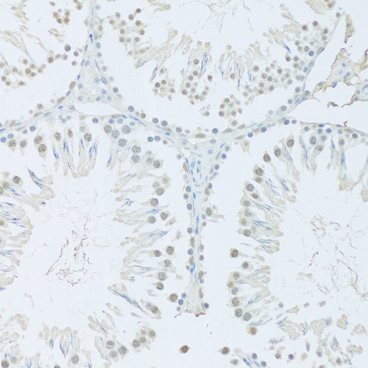 Immunohistochemistry of paraffin-embedded mouse liver using FIP1L1 antibody (22-733) at dilution of 1:100 (40x lens) .