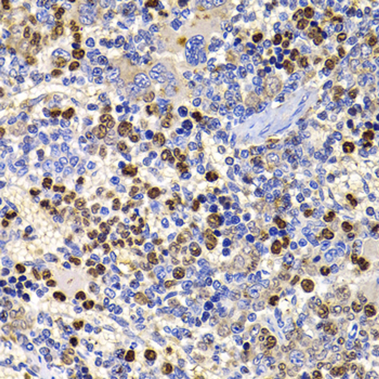 Immunohistochemistry of paraffin-embedded rat spleen using UBASH3B antibody (22-735) at dilution of 1:100 (40x lens) .