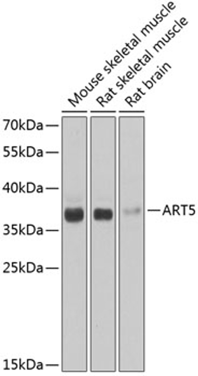 Western blot analysis of extracts of various cell lines, using ART5 antibody (22-738) at 1:1000 dilution.<br/>Secondary antibody: HRP Goat Anti-Rabbit IgG (H+L) at 1:10000 dilution.<br/>Lysates/proteins: 25ug per lane.<br/>Blocking buffer: 3% nonfat dry milk in TBST.<br/>Detection: ECL Basic Kit.<br/>Exposure time: 30s.