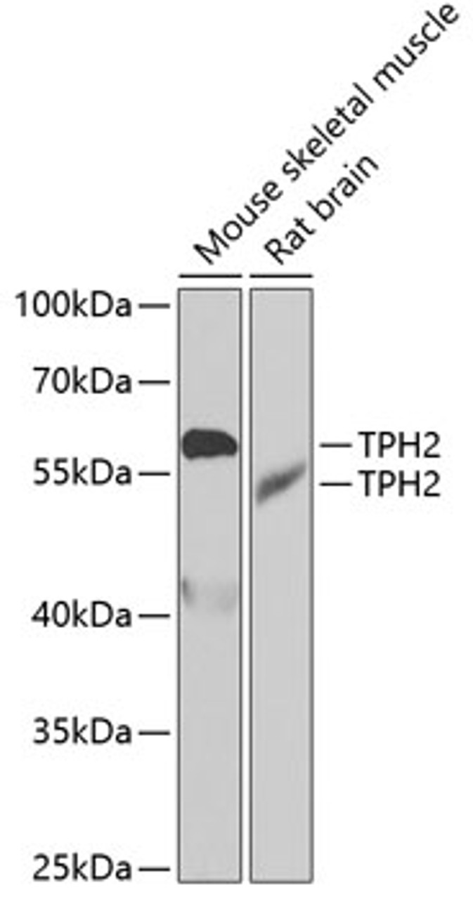Western blot analysis of extracts of various cell lines, using TPH2 antibody (22-739) at 1:1000 dilution.<br/>Secondary antibody: HRP Goat Anti-Rabbit IgG (H+L) at 1:10000 dilution.<br/>Lysates/proteins: 25ug per lane.<br/>Blocking buffer: 3% nonfat dry milk in TBST.<br/>Detection: ECL Basic Kit.<br/>Exposure time: 90s.