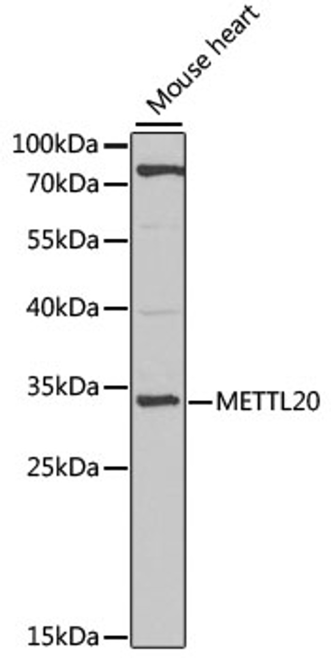 Western blot analysis of extracts of mouse heart, using METTL20 antibody (22-743) at 1:1000 dilution.<br/>Secondary antibody: HRP Goat Anti-Rabbit IgG (H+L) at 1:10000 dilution.<br/>Lysates/proteins: 25ug per lane.<br/>Blocking buffer: 3% nonfat dry milk in TBST.<br/>Detection: ECL Basic Kit.<br/>Exposure time: 90s.