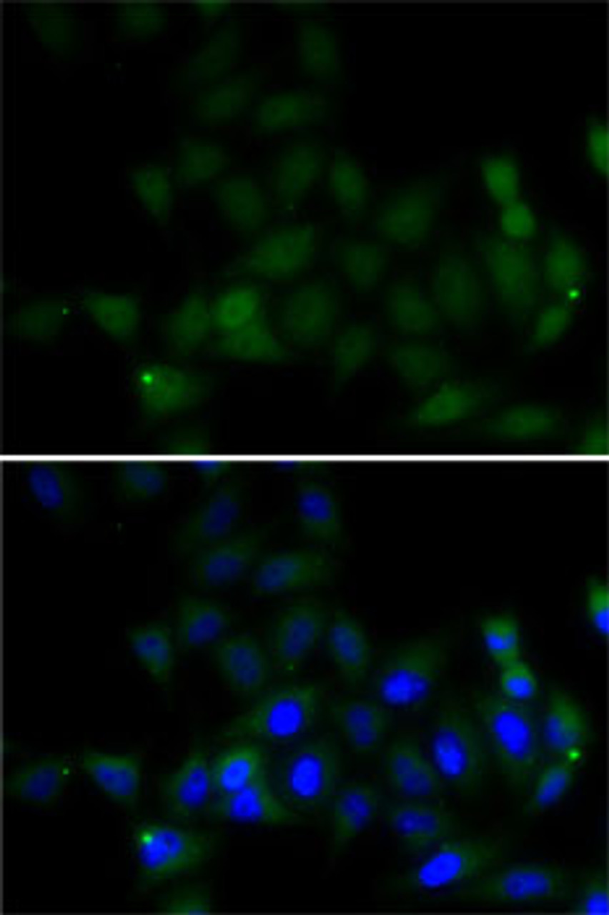 Immunofluorescence analysis of MCF7 cells using Histone H4 antibody (22-747) . Blue: DAPI for nuclear staining.