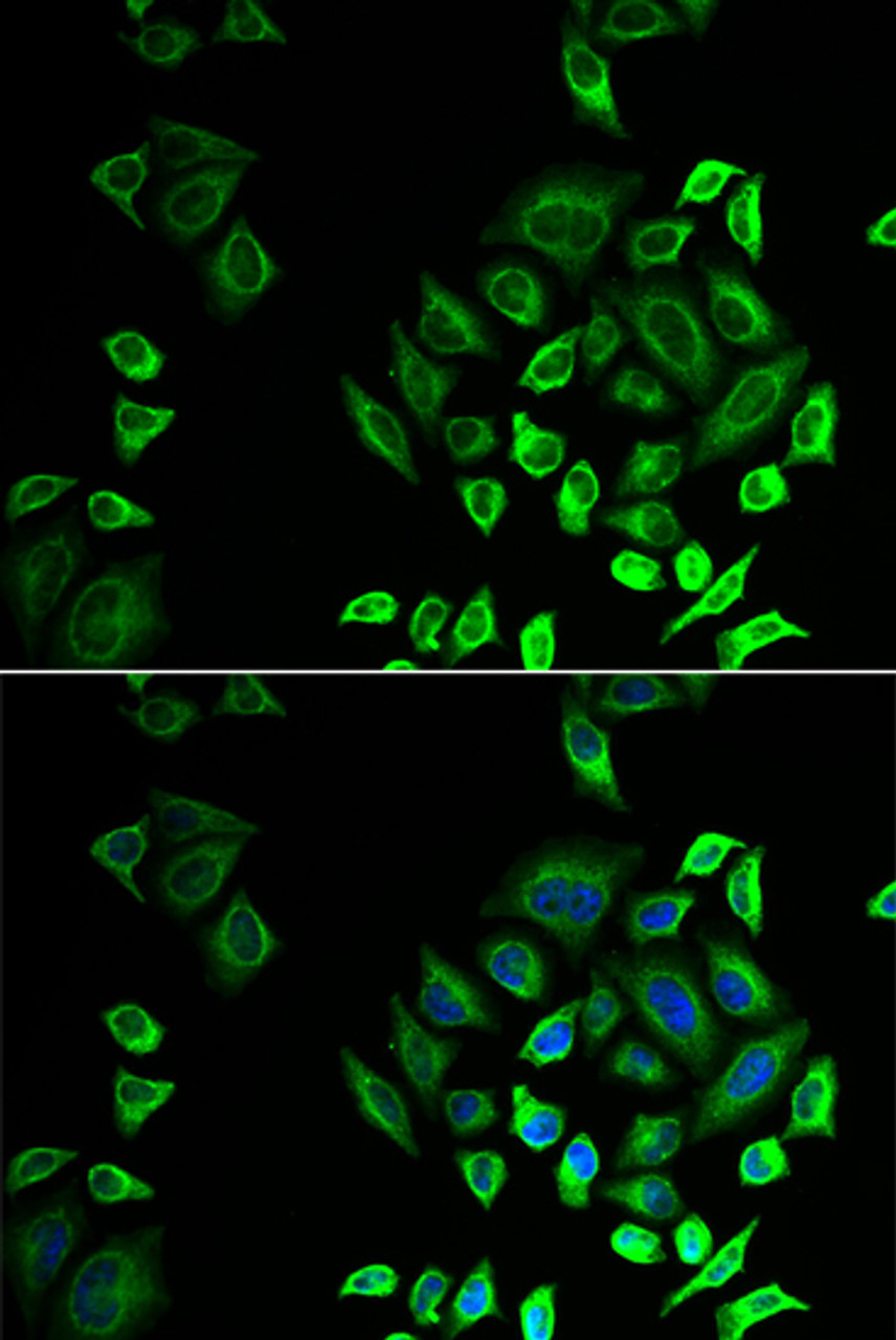 Immunofluorescence analysis of U2OS cells using PLA2G2D antibody (22-752) . Blue: DAPI for nuclear staining.