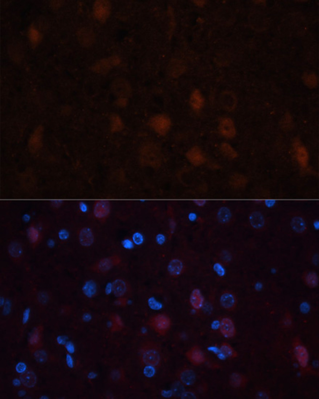 Immunofluorescence analysis of rat brain using GRIN1 antibody (22-753) at dilution of 1:100. Blue: DAPI for nuclear staining.