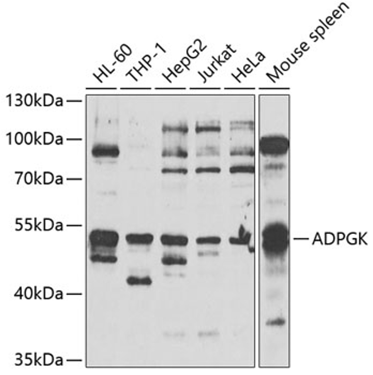 Western blot analysis of extracts of various cell lines, using ADPGK antibody (22-755) at 1:1000 dilution.<br/>Secondary antibody: HRP Goat Anti-Rabbit IgG (H+L) at 1:10000 dilution.<br/>Lysates/proteins: 25ug per lane.<br/>Blocking buffer: 3% nonfat dry milk in TBST.<br/>Detection: ECL Enhanced Kit.<br/>Exposure time: 90s.