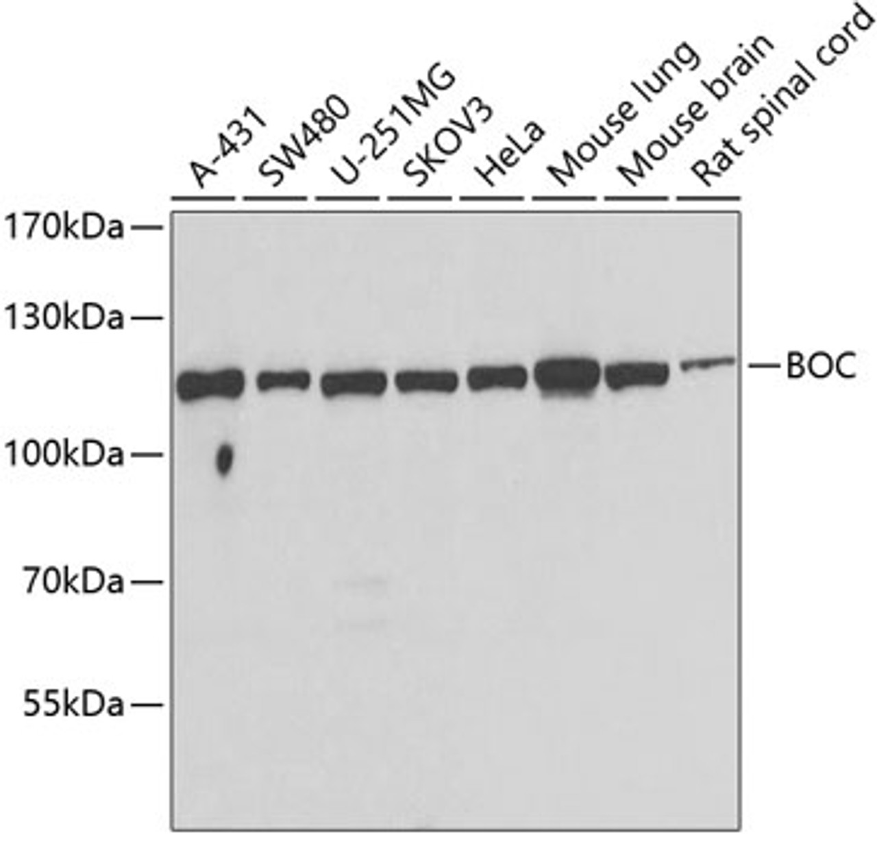 Western blot analysis of extracts of various cell lines, using BOC antibody (22-756) at 1:1000 dilution.<br/>Secondary antibody: HRP Goat Anti-Rabbit IgG (H+L) at 1:10000 dilution.<br/>Lysates/proteins: 25ug per lane.<br/>Blocking buffer: 3% nonfat dry milk in TBST.<br/>Detection: ECL Basic Kit.<br/>Exposure time: 60s.