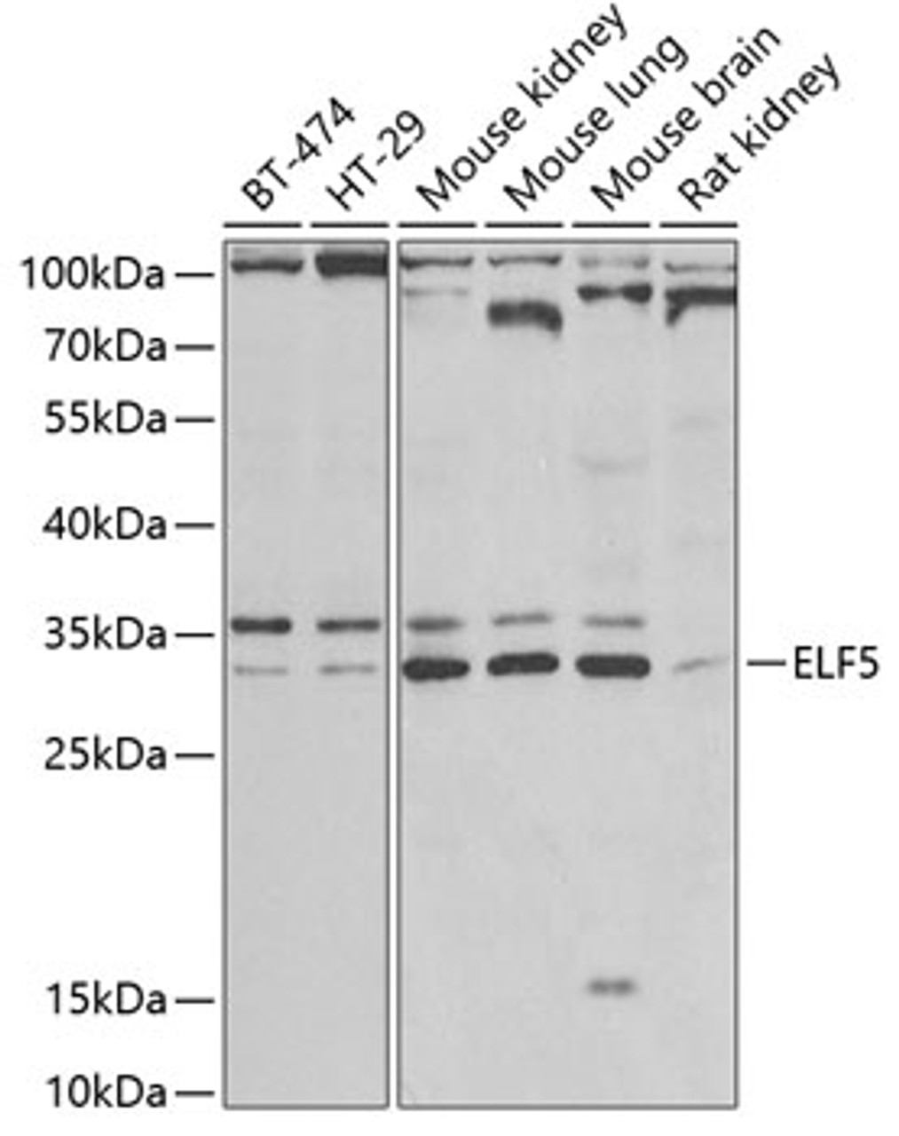 Western blot analysis of extracts of various cell lines, using ELF5 antibody (22-761) at 1:1000 dilution.<br/>Secondary antibody: HRP Goat Anti-Rabbit IgG (H+L) at 1:10000 dilution.<br/>Lysates/proteins: 25ug per lane.<br/>Blocking buffer: 3% nonfat dry milk in TBST.<br/>Detection: ECL Basic Kit.<br/>Exposure time: 90s.