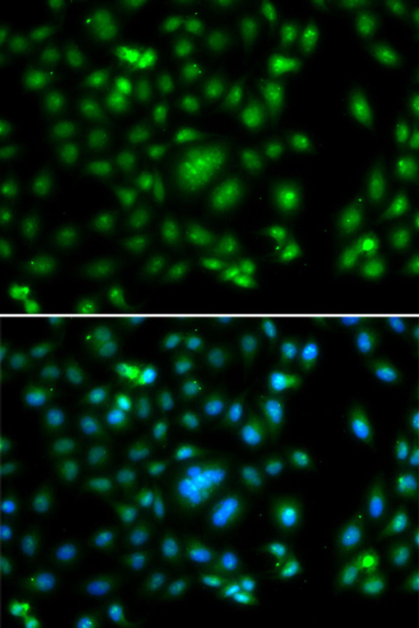 Immunofluorescence analysis of A549 cells using ELF5 antibody (22-761) . Blue: DAPI for nuclear staining.